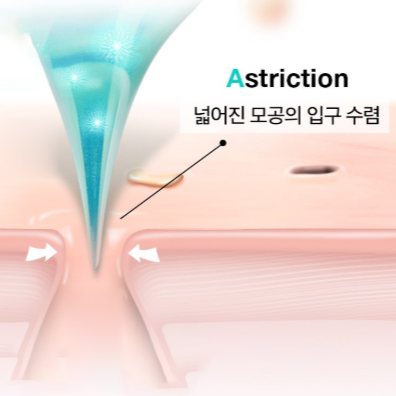 Pore Care Microneedle Patch ODM Solutions