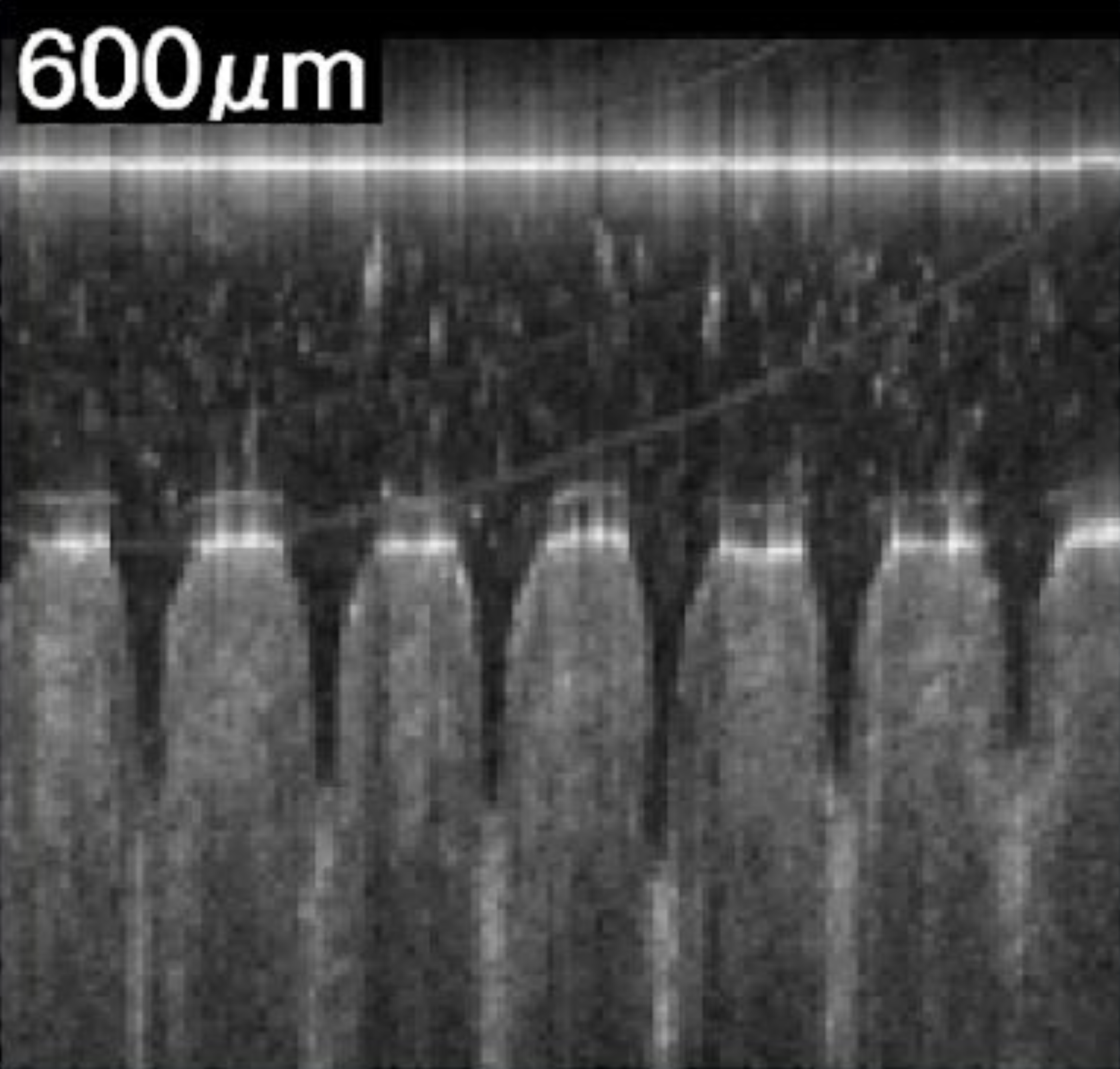 600um placeholder
